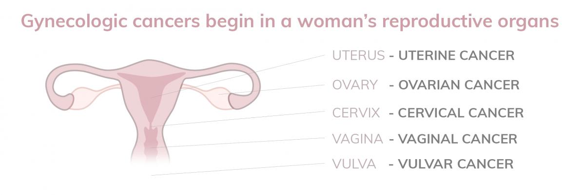 Gynecologic cancers begin in a woman's reproductive organs