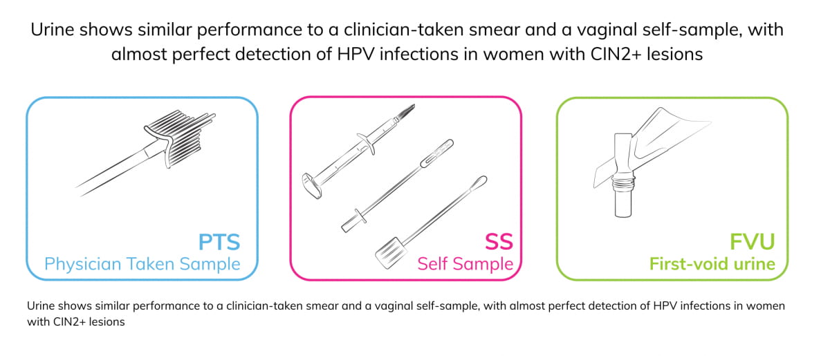 Urine sample types compared