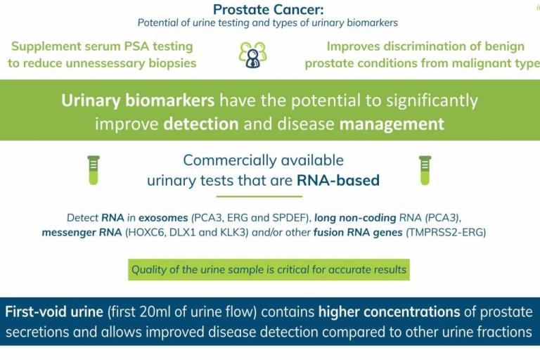 Prostate cancer infographic