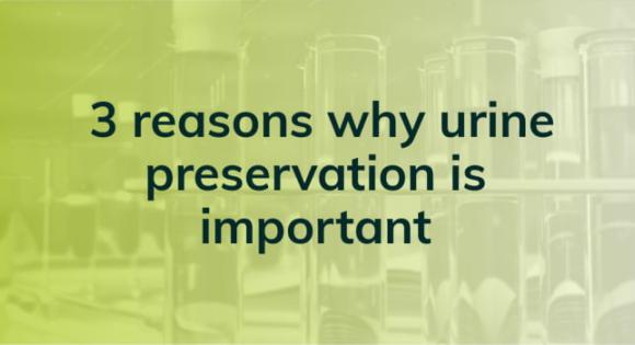 3 reasons why urine preservation is important